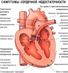 Таблица №15: Симптомы сердечной недостаточности