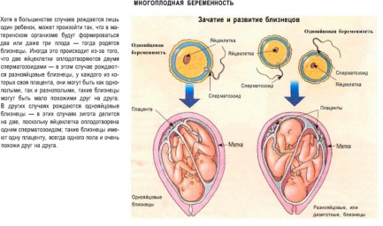 Таблица №14: Многоплодная беременность