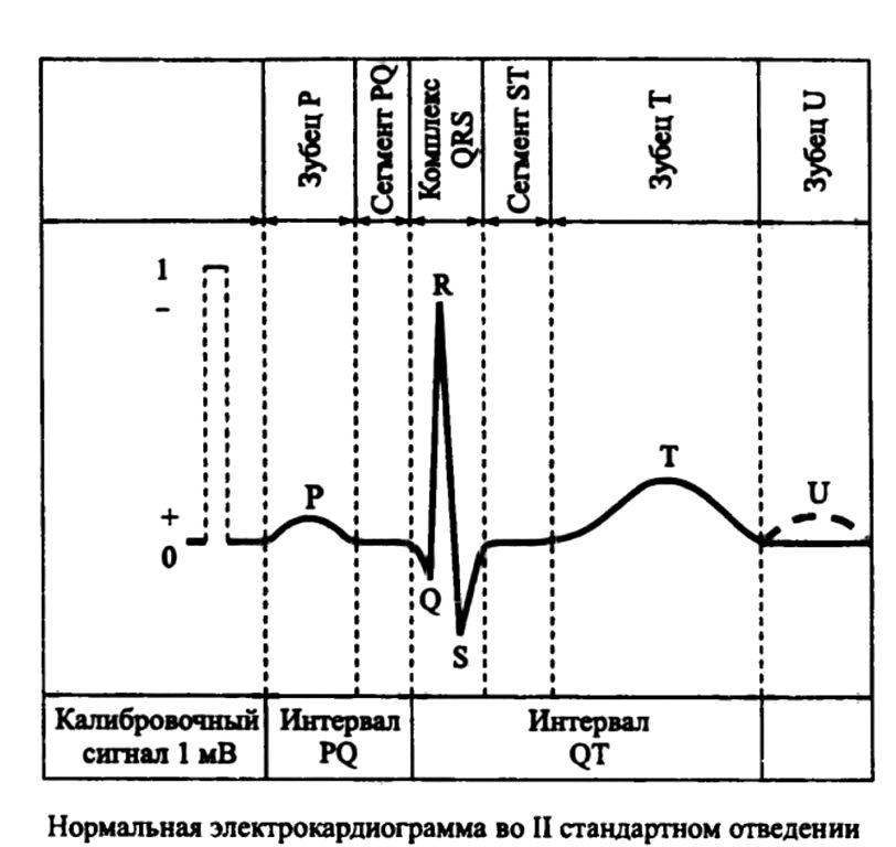 Нормальная электрокардиограмма во II стандартном отведении